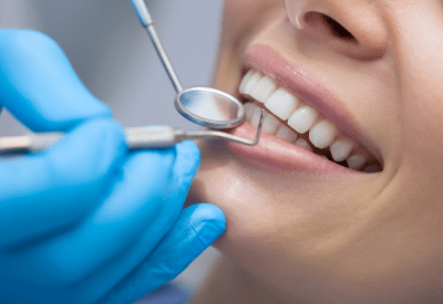 root canal treatment in Madinaguda