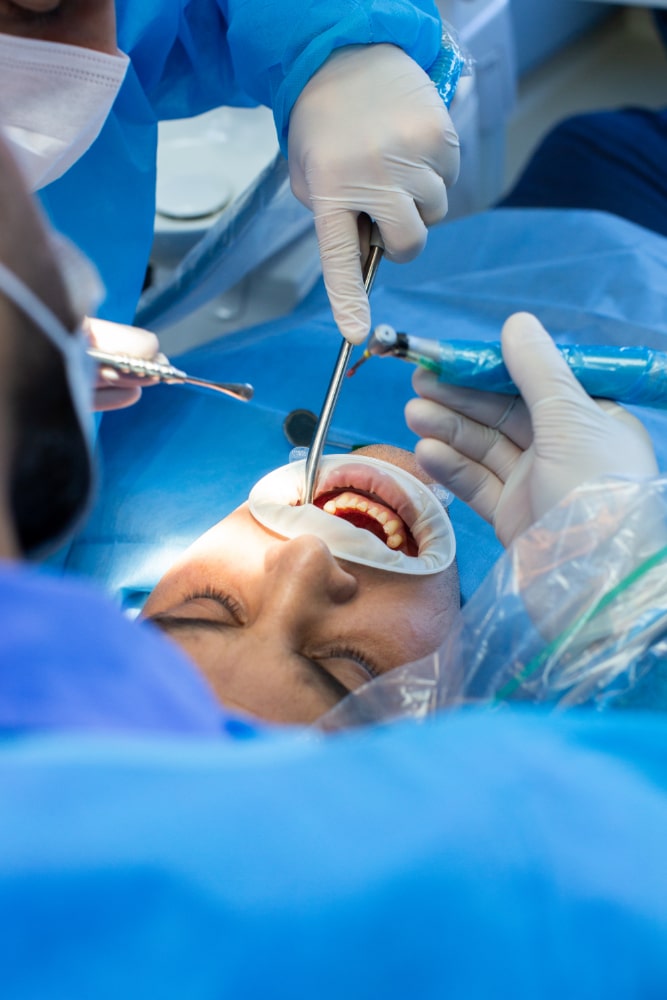 Oral Surgery