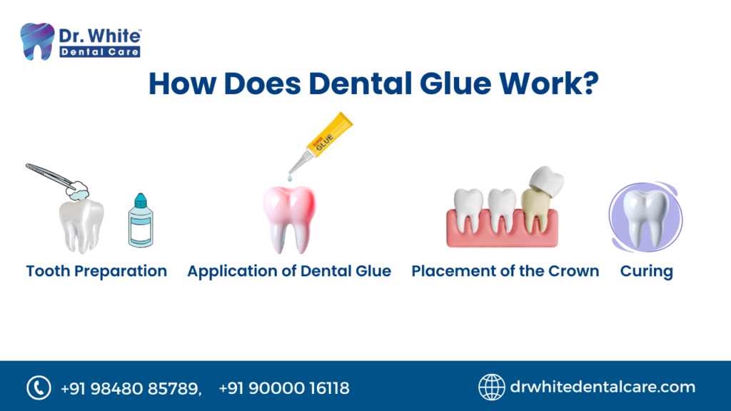 The Complete Guide to Dental Glue for Crowns