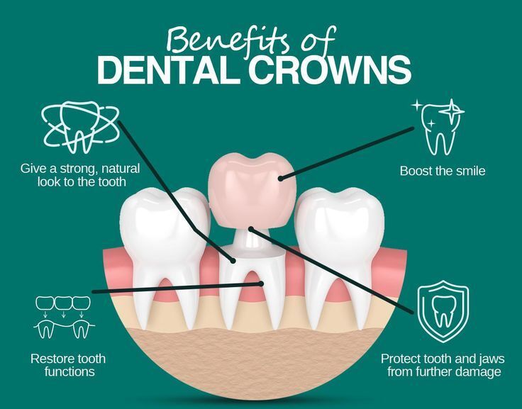Dental Crowns and Bridges Treatment in Hyderabad