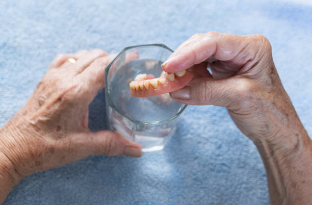 Dentures Treatment in Hyderabad