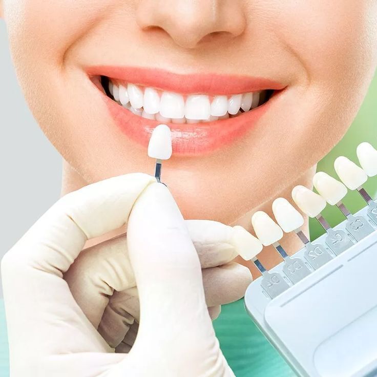 Smile Makeover Treatment in Hyderabad