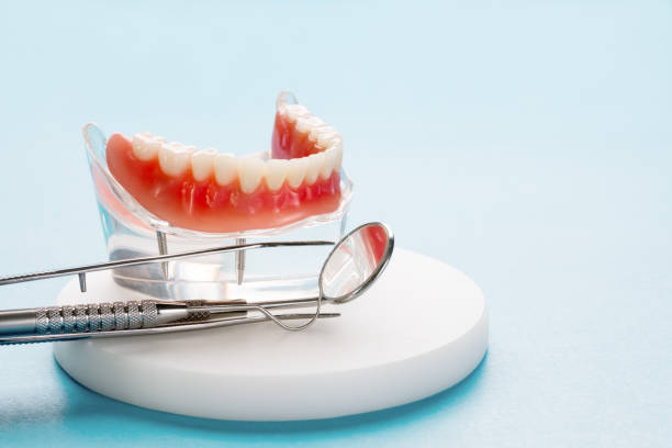 Dentures Treatment in Hyderabad