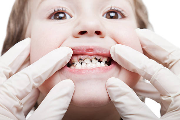 Pediatric Dentist in Madinaguda