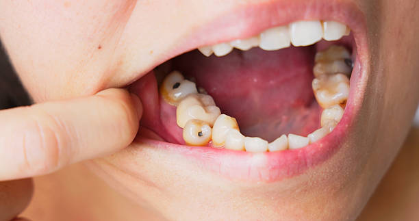 Pediatric Dentist in Madinaguda