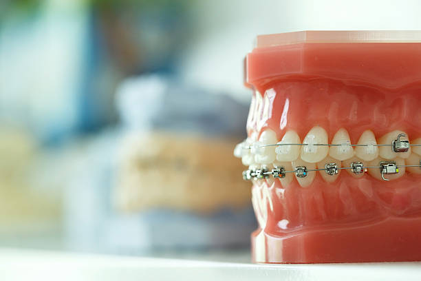 Dental Braces Treatment in Madinaguda