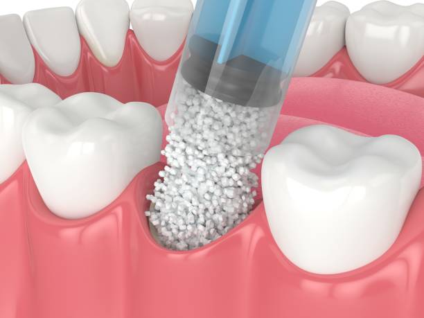 Oral Surgery Treatment In Madinaguda