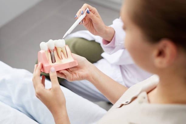 Dental Implants in Hyderabad