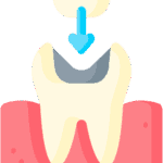 Dental_Fillings.png