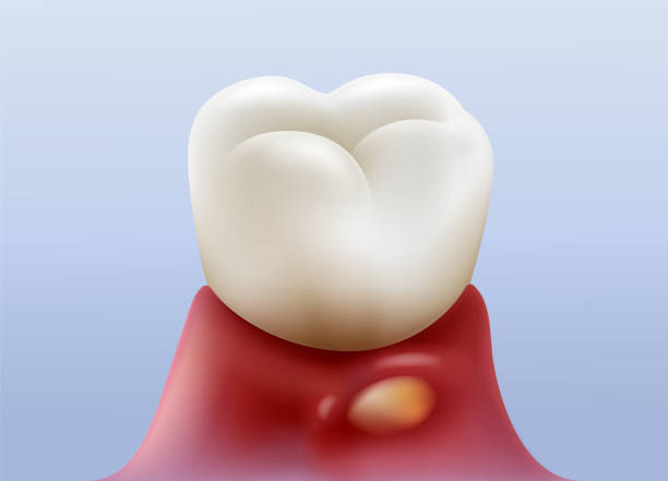 Best Gum Specialist in Hyderabad