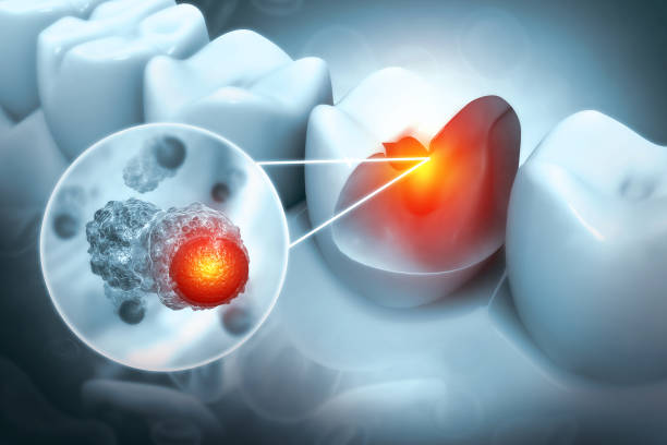 Gum Disease Treatment in Madinaguda