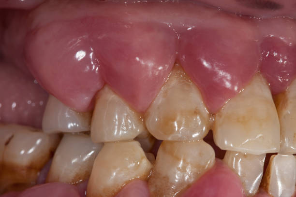 Best Gum Specialist in Hyderabad