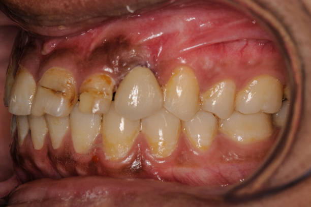 Best Gum Specialist in Hyderabad