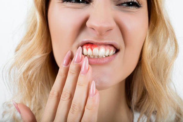 Best Gum Specialist in Hyderabad