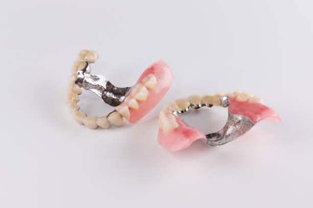 Dental Crowns and Bridges Treatment in Madinaguda