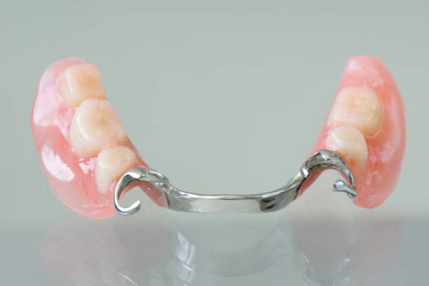 Dentures Treatment in Madinaguda