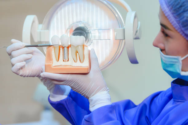 Dental Crowns and Bridges