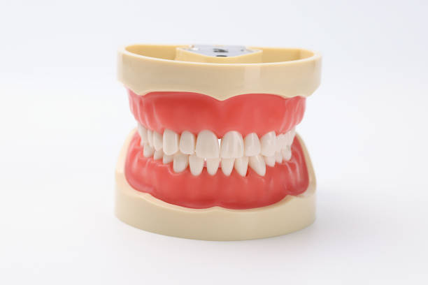 Smile Makeover Treatment in Hyderabad