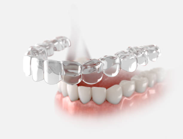 Smile Makeover Treatment in Hyderabad