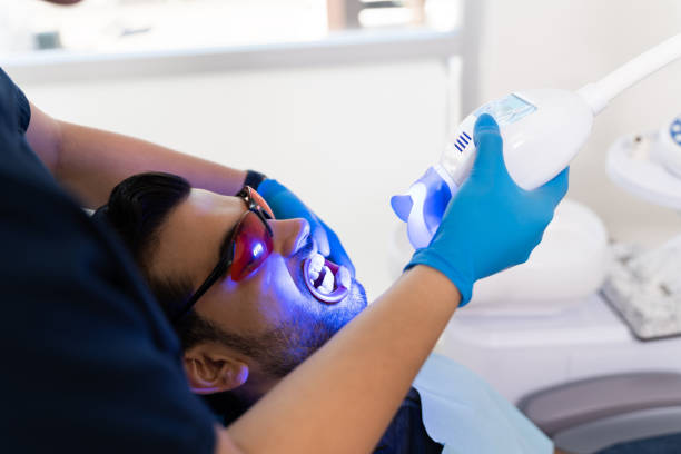 Teeth Whitening in Hyderabad