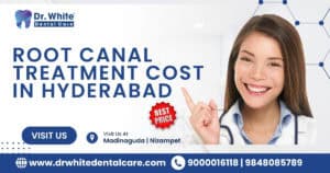 Root Canal Treatment Cost in Hyderabad