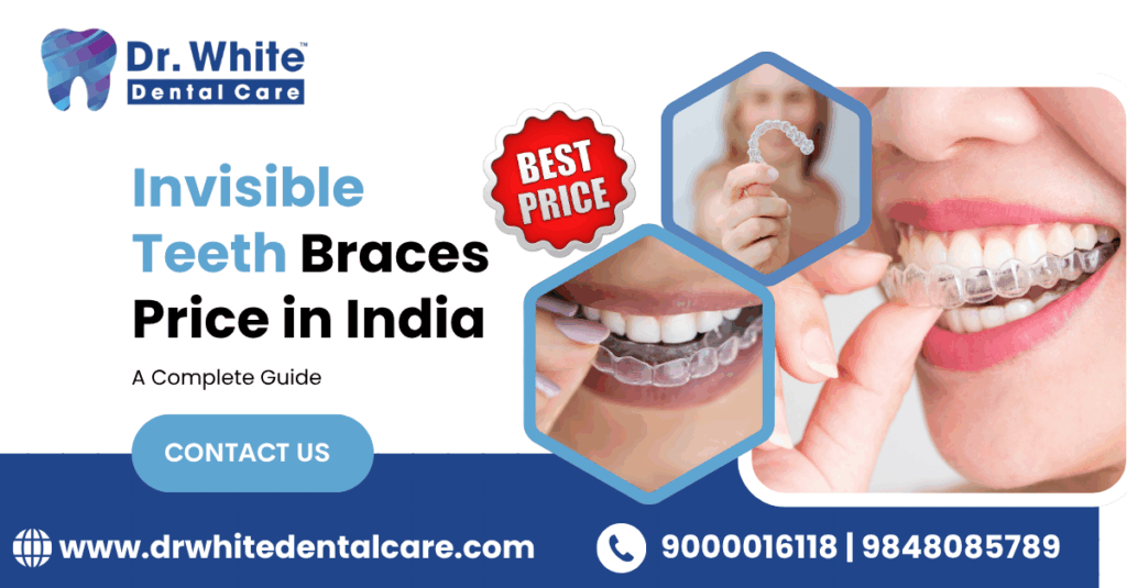 Invisible Teeth Braces Price in India