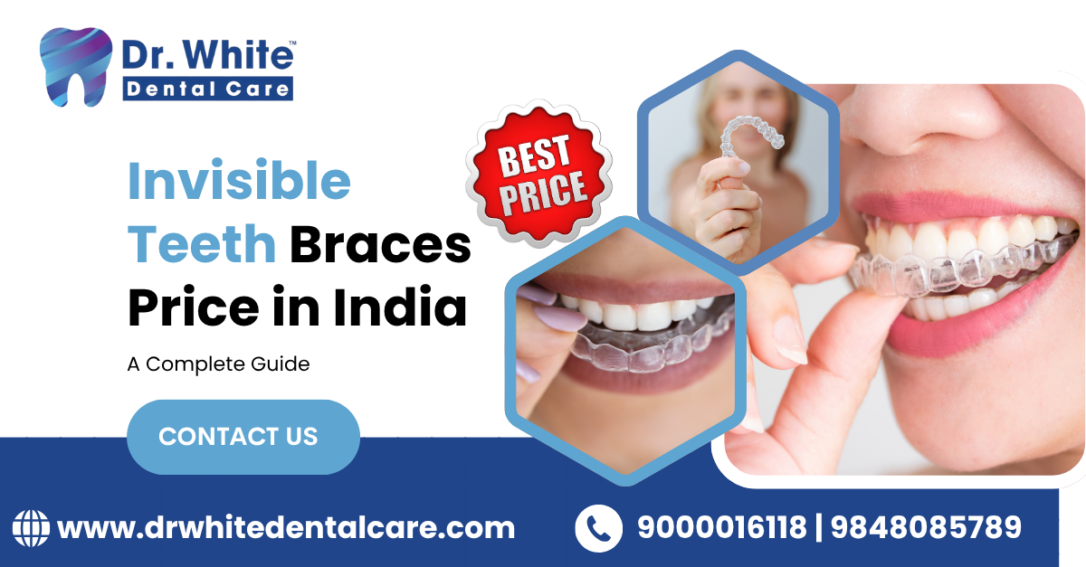 Invisible Teeth Braces Price in India