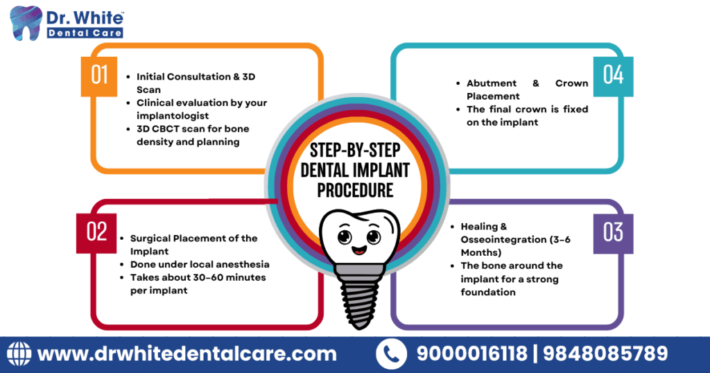 Dental Implant Cost