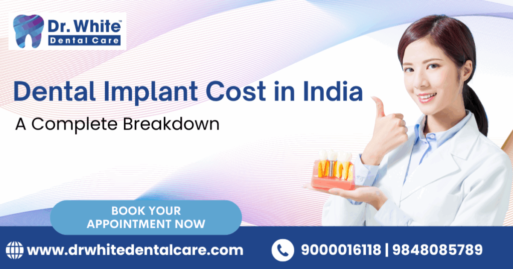 Dental Implant Cost in India
