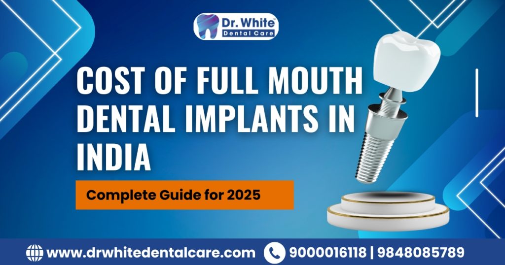 Cost of Full Mouth Dental Implants in India