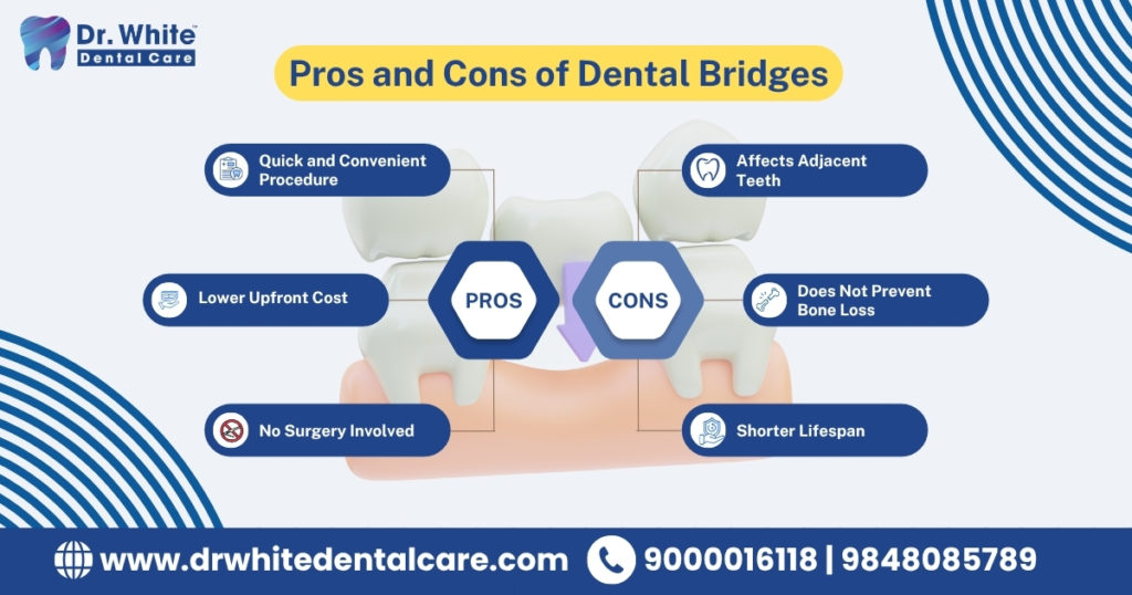 Pros and Cons of Dental Bridges
