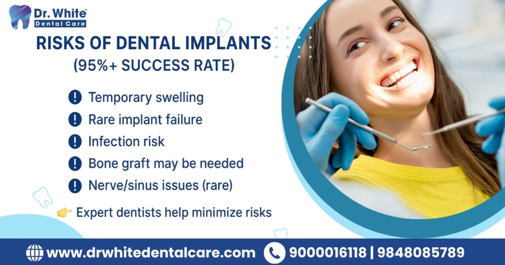 Risks of Dental Implants