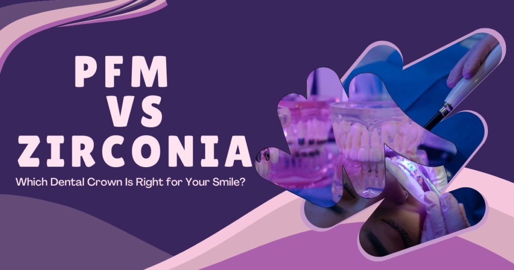 PFM vs Zirconia