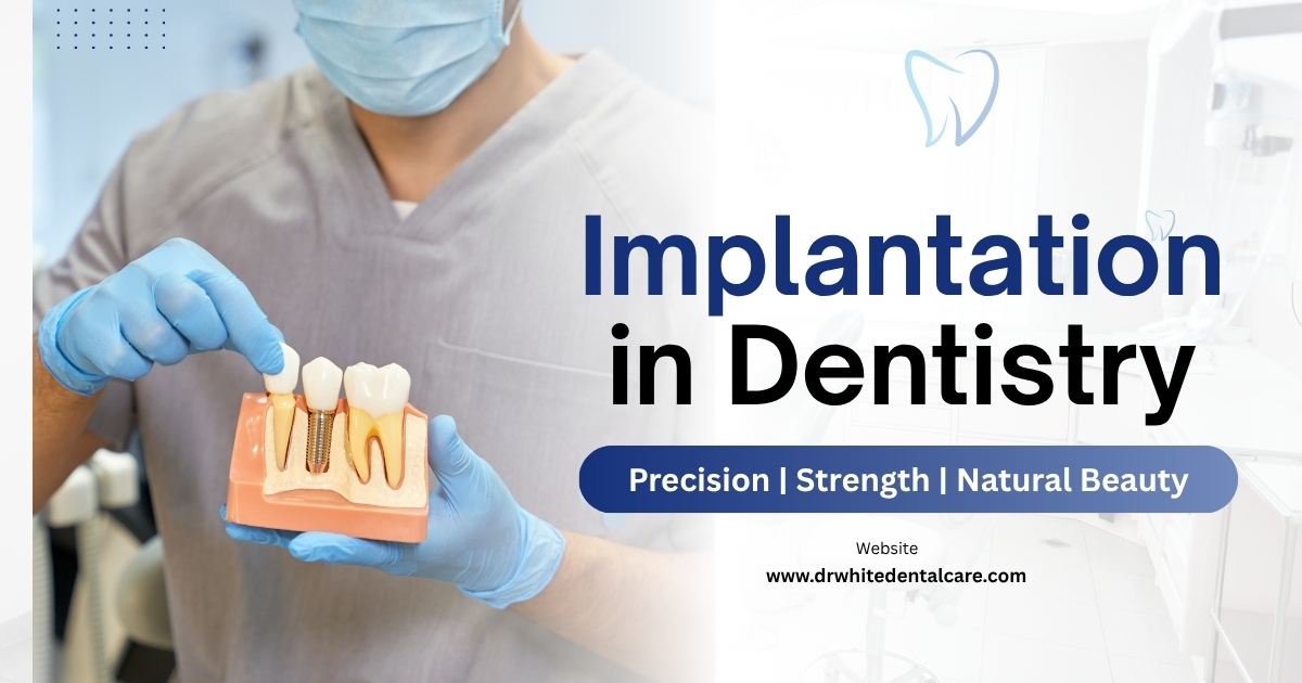 Implantation in Dentistry