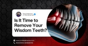 Wisdom Tooth When to Remove
