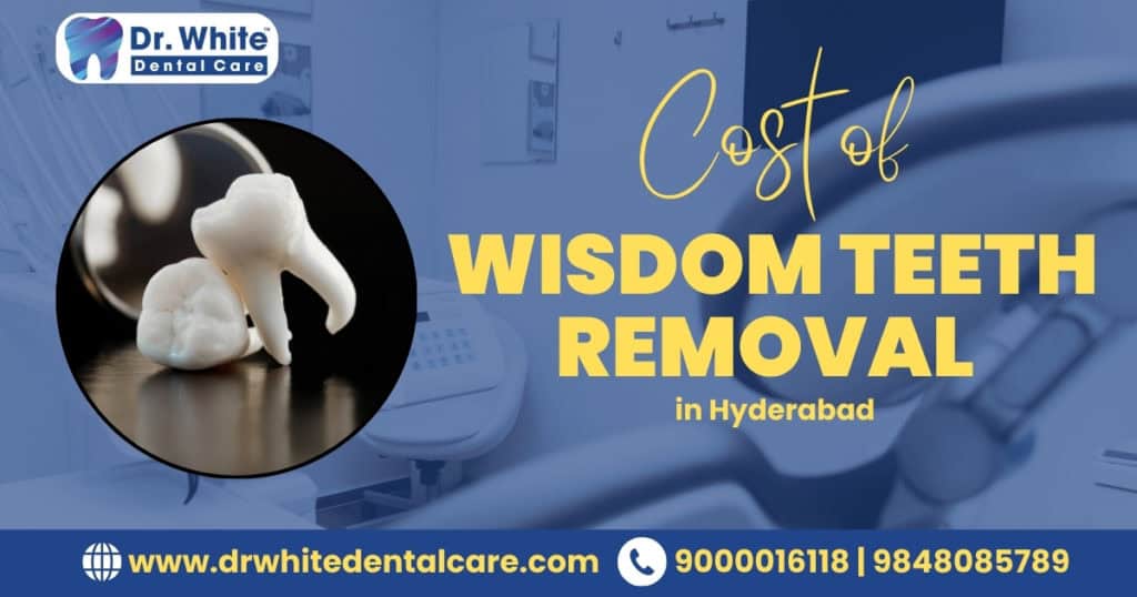 Wisdom Teeth Removal Cost in Hyderabad