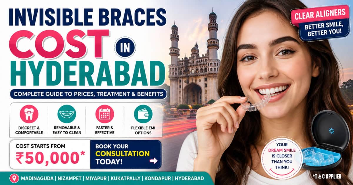 Invisible Braces Cost in Hyderabad
