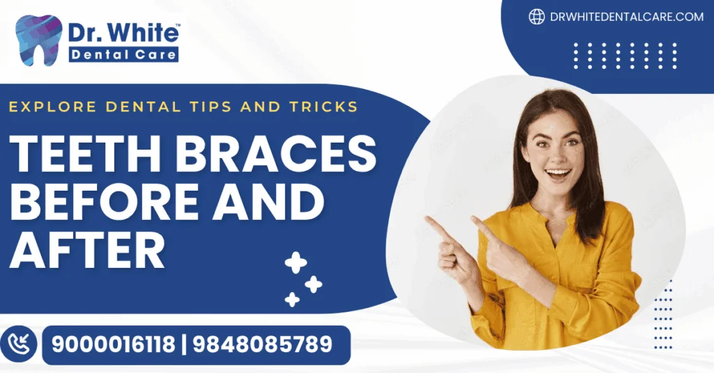 teeth braces before and after