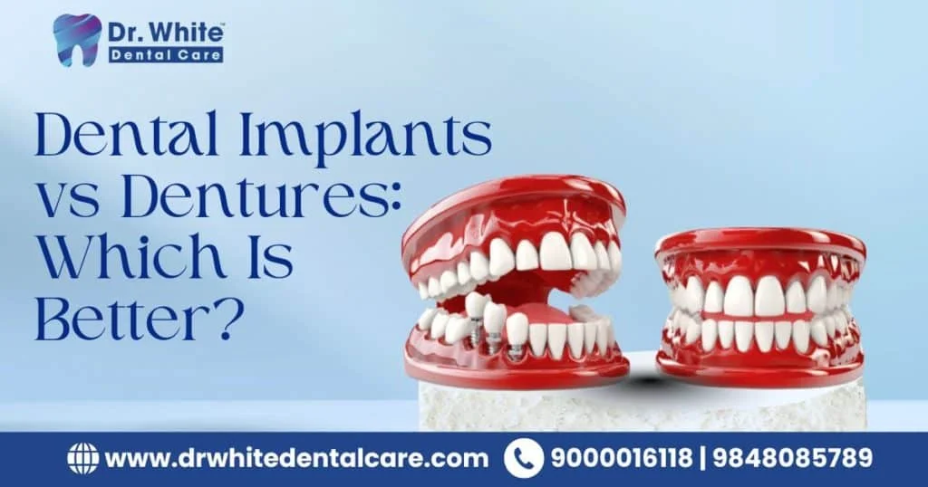 Dental Implants vs Dentures: Which Is Better