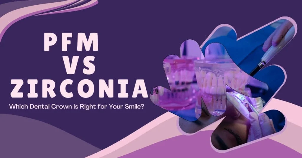 PFM vs Zirconia