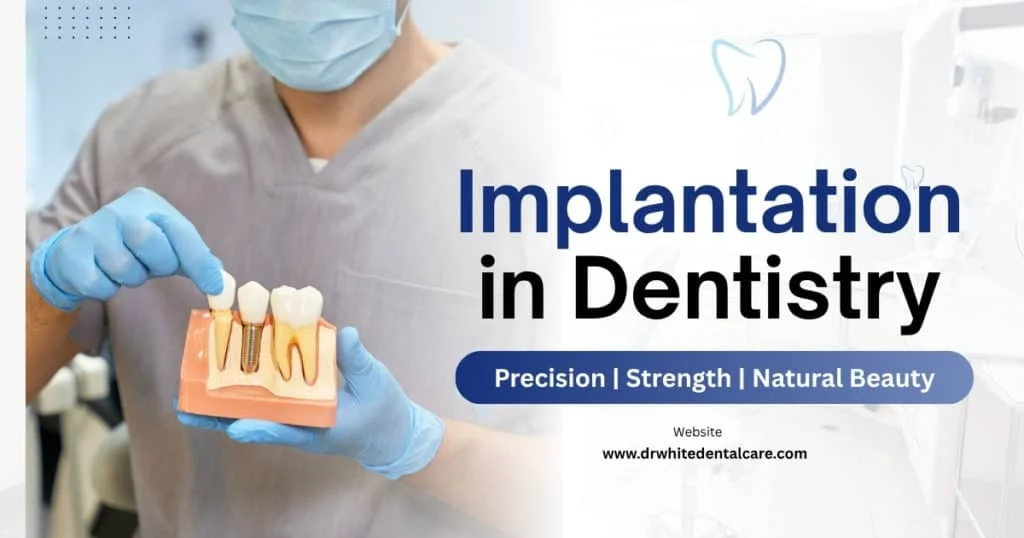 Implantation in Dentistry