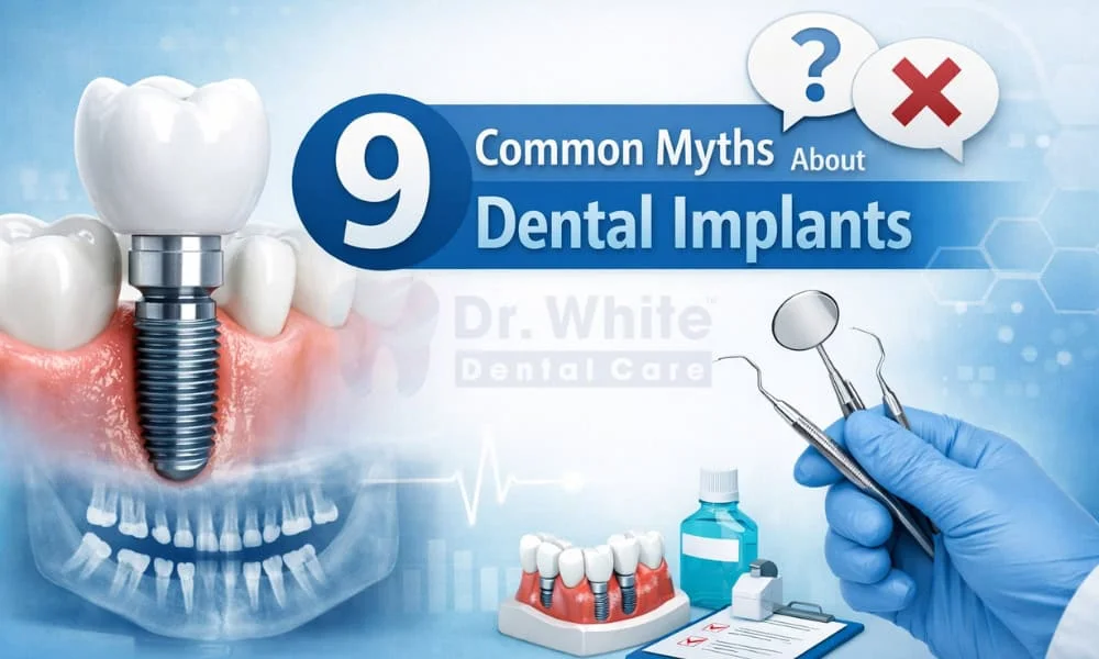 9 Common Myths about Dental Implants